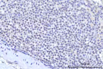 RBM22 Antibody