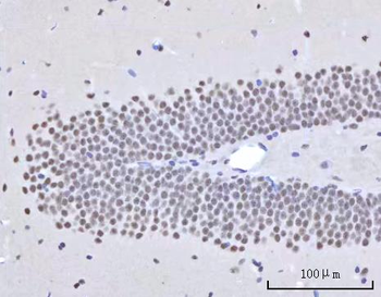 RBM22 Antibody