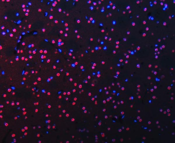 RBM22 Antibody