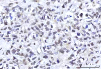 RBM22 Antibody