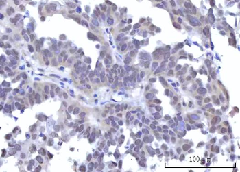 RBM22 Antibody
