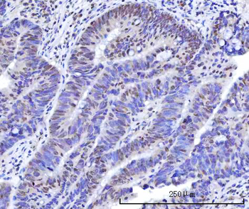 RBM15B Antibody