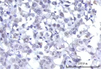 RBM15B Antibody