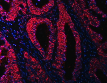 RBM15B Antibody