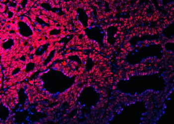 RBM15B Antibody