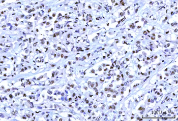 RBM15B Antibody