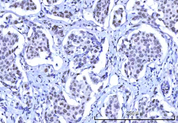 RBM15B Antibody