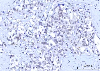 RBM15B Antibody