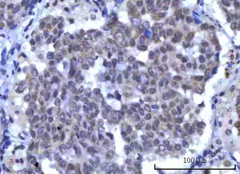 RBM15B Antibody