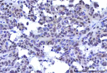 RBM15B Antibody