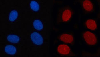 RANBP2 Rabbit Polyclonal Antibody