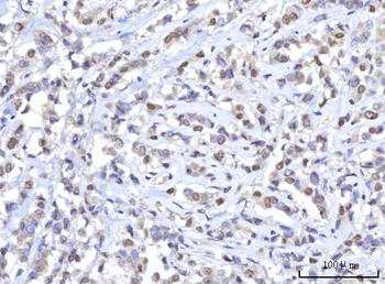 RANBP2 Rabbit Polyclonal Antibody