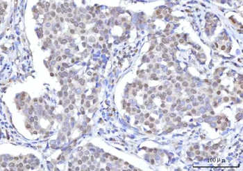 RANBP2 Rabbit Polyclonal Antibody