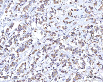 C18orf22/RBFA Antibody