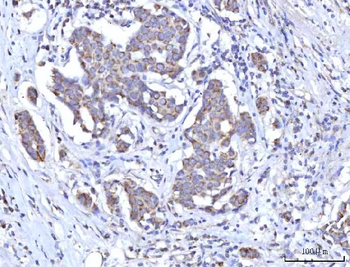C18orf22/RBFA Antibody