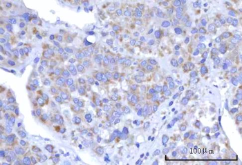 C18orf22/RBFA Antibody