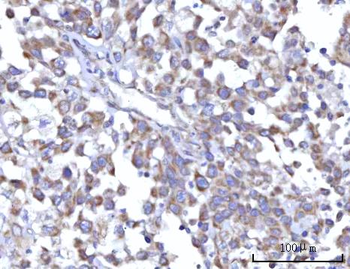 C18orf22/RBFA Antibody