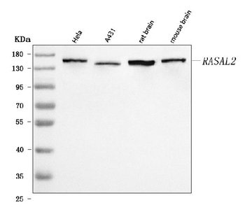 RASAL2 Rabbit Polyclonal Antibody