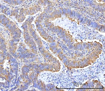 RARS/RARS1 Antibody