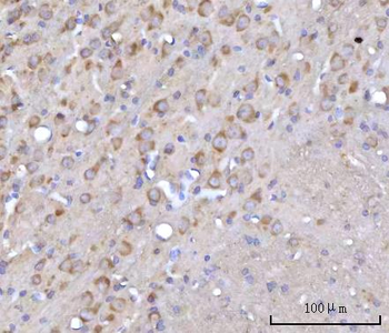 RARS/RARS1 Antibody