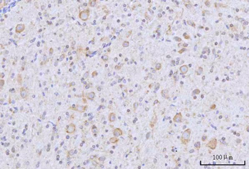 RARS/RARS1 Antibody