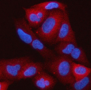 RAP1GAP Rabbit Polyclonal Antibody