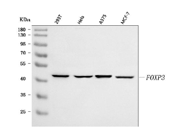 FOXP3 Rabbit Polyclonal Antibody