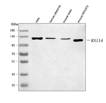 RAI14 Rabbit Polyclonal Antibody