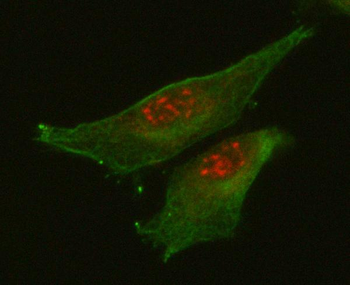 RETREG1 Rabbit Polyclonal Antibody