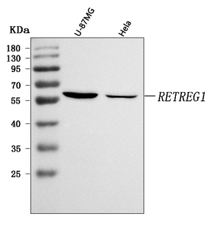 RETREG1 Rabbit Polyclonal Antibody