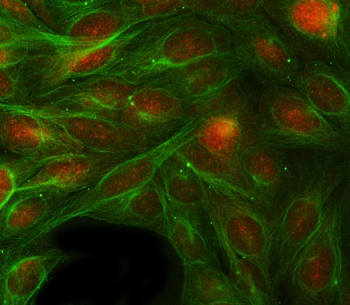 RBP1 Antibody