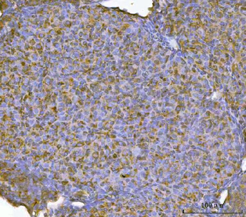 RBP1 Antibody