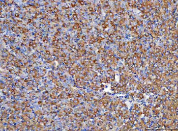 RBP1 Antibody