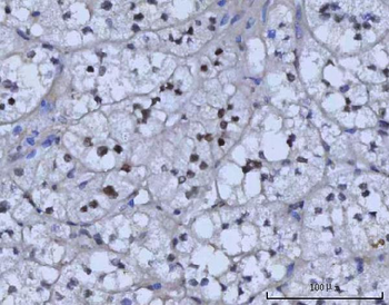 RAD51C Rabbit Polyclonal Antibody