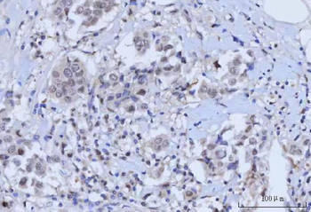 RAD51C Rabbit Polyclonal Antibody