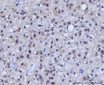 RAD51C Rabbit Polyclonal Antibody