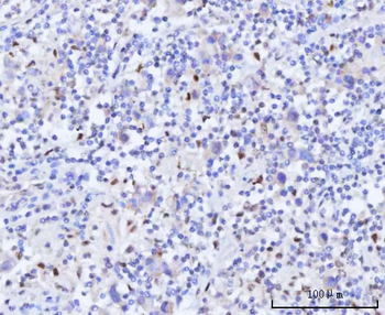 RAD51C Rabbit Polyclonal Antibody