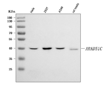 RAD51C Rabbit Polyclonal Antibody