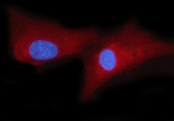 WRS/WARS1 Rabbit Polyclonal Antibody