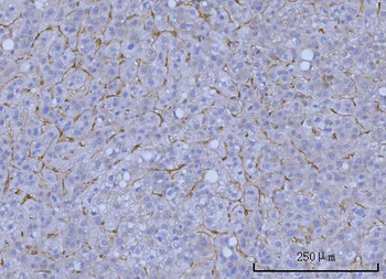 WRS/WARS1 Rabbit Polyclonal Antibody