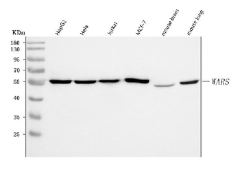 WRS/WARS1 Rabbit Polyclonal Antibody