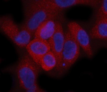 Hamartin/TSC1 Antibody