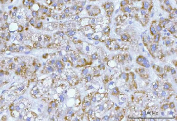 Hamartin/TSC1 Antibody