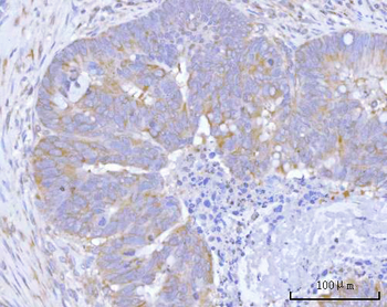 Hamartin/TSC1 Antibody