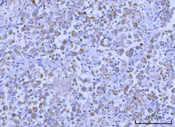Hamartin/TSC1 Antibody