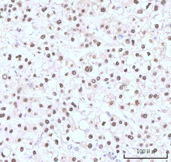 Nesprin3/SYNE3 Antibody