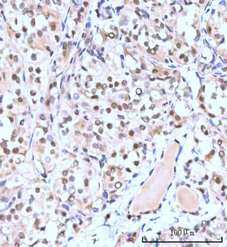 Nesprin3/SYNE3 Antibody