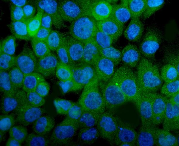 ITGA8 Rabbit Polyclonal Antibody