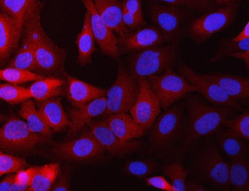 NQO1 Rabbit Polyclonal Antibody