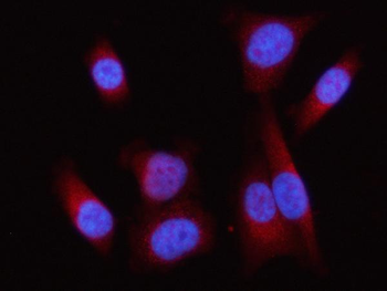 Lipin 1/LPIN1 Rabbit Polyclonal Antibody